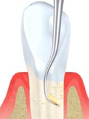 Dental Periodintic Exam image