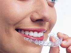 Invisalign image